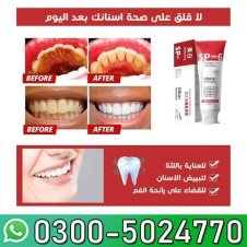 SP-6 Probiotic Toothpaste In Pakistan