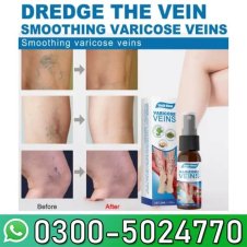 South Moon Varicose Veins Treatment Spray Price In Pakistan