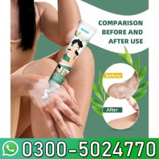 Vitiligo Ointment Remove Ringworm In Pakistan