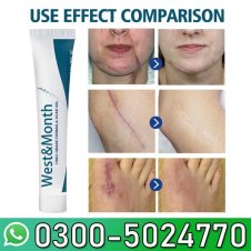 West&amp;month Fade Body Scar Repair Gel In Pakistan